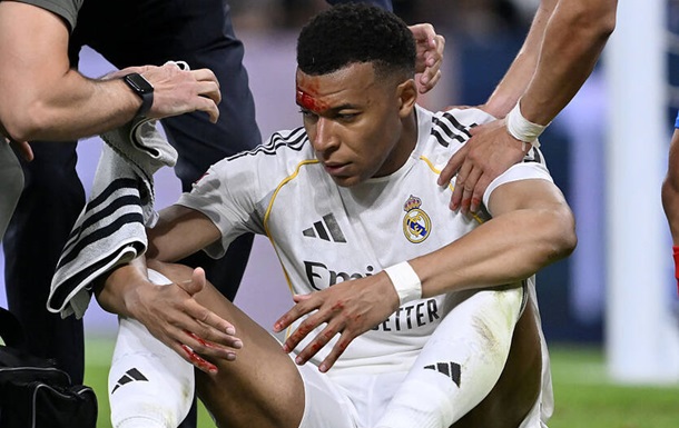 Мбаппе сыграет против «Баварии» несмотря на травму